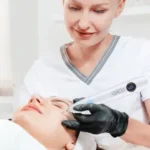 How to Remove Flat Moles From Face Permanently